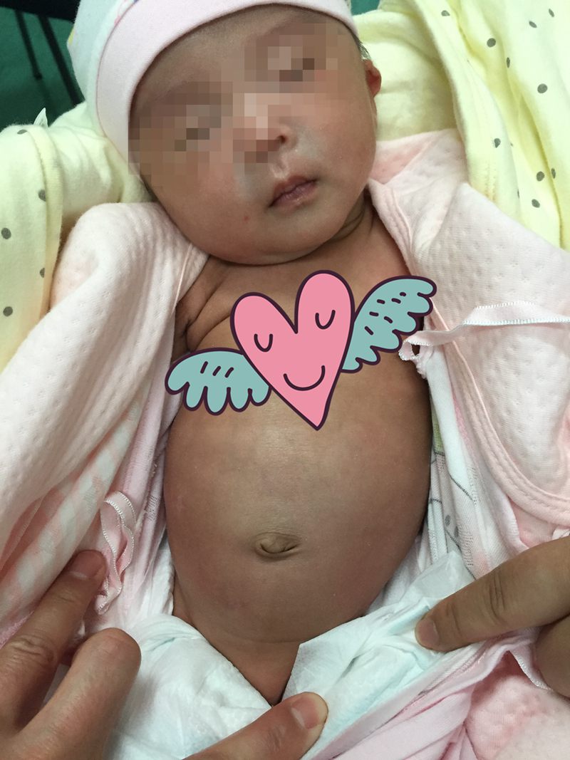 复查图_副本_副本 - 副本.jpg